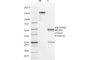 SDS-PAGE Analysis Purified HPV-16 Mouse Monoclonal Antibody (HPV16/1295). (HPV16 antibody)