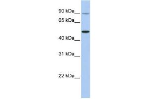 TRPV5 antibody  (N-Term)