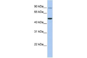 WB Suggested Anti-TRPV5 Antibody Titration:  0. (TRPV5 antibody  (N-Term))