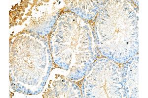 ABIN7094535 and ABIN7098584 at 1/100 staining Rat testis tissue by IHC-P. (APH1A antibody  (C-Term))