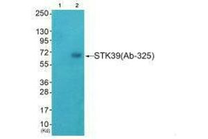 STK39 anticorps  (Ser325)