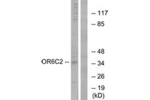 Western blot analysis of extracts from HT-29 cells, using OR6C2 Antibody. (OR6C2 antibody  (AA 231-280))