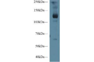 Western blot analysis of Pig Skeletal muscle lysate, using Human LIFR Antibody (1 µg/ml) and HRP-conjugated Goat Anti-Rabbit antibody (