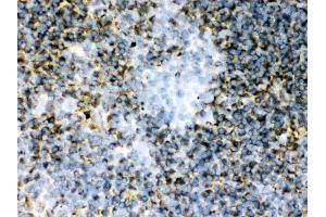 Immunohistochemistry (IHC) image for anti-Transglutaminase 2 (C Polypeptide, Protein-Glutamine-gamma-Glutamyltransferase) (TGM2) (AA 7-34), (N-Term) antibody (ABIN3043946)