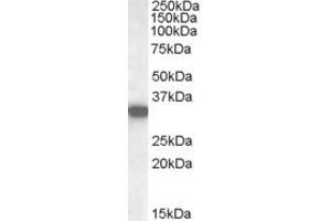 ABIN238619 (0. (HADH antibody  (Internal Region))