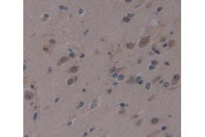 Used in DAB staining on fromalin fixed paraffin- embedded brain tissue (AHRR antibody  (AA 1-182))