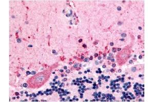 Immunohistochemical staining of human brain (Purkinje Neurons) using anti-CELSR3 antibody (CELSR3 antibody  (N-Term))