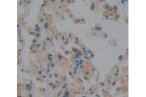 Figure. (Peroxidasin antibody  (AA 76-260))