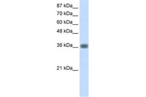 Western Blotting (WB) image for anti-Kelch Domain Containing 8A (KLHDC8A) antibody (ABIN2462280)