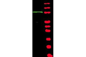 Western blot using Affinity Purified anti-BACH1 antibody shows detection of a band at ~105 kDa (lane 1) corresponding to human BACH1 present in a 293 whole cell lysate (arrowhead). (BRIP1 antibody  (Isoform 1))