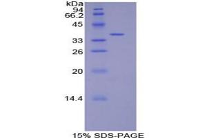 SDS-PAGE analysis of Rat Defensin beta 2 Protein. (beta 2 Defensin Protein)