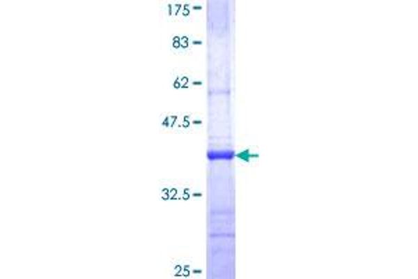 CNKSR1 Protein (AA 111-210) (GST tag)