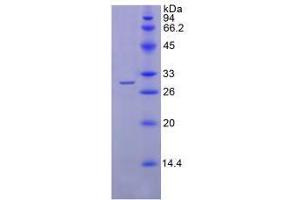 SDS-PAGE analysis of Human SGPL1 Protein.