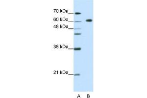 WB Suggested Anti-GMEB2 Antibody Titration:  1. (GMEB2 antibody  (C-Term))