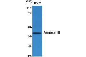Western Blot (WB) analysis of specific cells using Annexin III Polyclonal Antibody. (Annexin A3 antibody  (Internal Region))