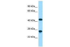 Host:  Rabbit  Target Name:  Dmbx1  Sample Type:  Mouse Stomach lysates  Antibody Dilution:  1. (DMBX1 antibody  (C-Term))