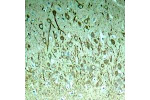 Immunohistochemical analysis of paraffin-embedded rat hippocampal region tissue from a model with Alzheimer (MAPT antibody  (pThr231))