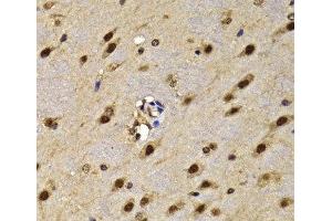Immunohistochemistry of paraffin-embedded Mouse brain using HMG20A Polyclonal Antibody at dilution of 1:100 (40x lens). (HMG20A antibody)