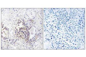 Immunohistochemistry (IHC) image for anti-Choroideremia-Like (Rab Escort Protein 2) (CHML) (Internal Region) antibody (ABIN1851923) (CHML antibody  (Internal Region))
