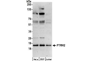 anti-Peptidyl-tRNA Hydrolase 2 (PTRH2) (AA 129-179) antibody