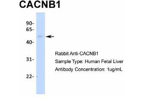 Host:  Rabbit  Target Name:  CACNB1  Sample Type:  Human Fetal Liver  Antibody Dilution:  1. (CACNB1 antibody  (N-Term))
