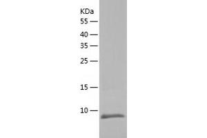 Western Blotting (WB) image for Sec61 beta Subunit (SEC61B) (AA 1-70) protein (His tag) (ABIN7286589) (SEC61B Protein (AA 1-70) (His tag))