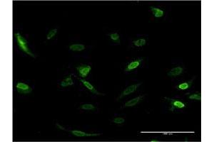 Immunofluorescence of monoclonal antibody to CDC2L6 on HeLa cell. (CDK19 antibody  (AA 367-467))