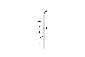 Anti-PRDM16 Antibody (Center) at 1:2000 dilution + Jurkat whole cell lysate Lysates/proteins at 20 μg per lane. (PRDM16 antibody  (AA 771-804))