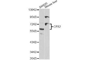 Western blot analysis of extracts of various cell lines, using CES2 antibody (ABIN5970708) at 1/1000 dilution. (CES2 antibody)