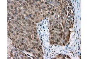 Immunohistochemical staining of paraffin-embedded colon tissue using anti-BTK mouse monoclonal antibody. (BTK antibody)