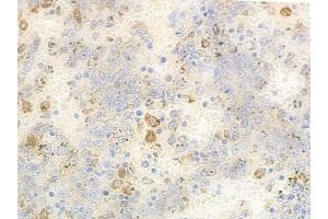 anti-Acylglycerol Kinase (AGK) (C-Term) antibody