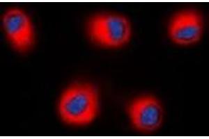 Immunofluorescent analysis of STEAP2 staining in HEK293T cells. (STEAP2 antibody  (C-Term))