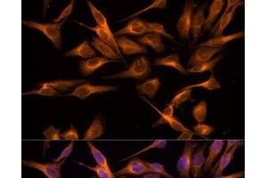 Immunofluorescence analysis of HeLa cells using UNG Polyclonal Antibody at dilution of 1:100. (UNG antibody)