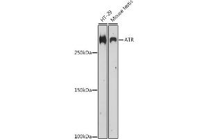 Western blot analysis of extracts of various cell lines, using ATR antibody (ABIN6131207, ABIN6137357, ABIN6137359 and ABIN6218135) at 1:500 dilution. (ATR antibody  (AA 400-650))