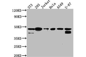 Western Blot Positive WB detected in: NIH/3T3 whole cell lysate, 293 whole cell lysate, Jurkat whole cell lysate, Hela whole cell lysate, A549 whole cell lysate, U-87 whole cell lysate All lanes: CKII alpha antibody at 1:1000 Secondary Goat polyclonal to rabbit IgG at 1/50000 dilution Predicted band size: 46, 30 kDa Observed band size: 45 kDa (Recombinant CSNK2A1/CK II alpha antibody)