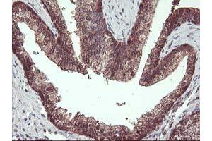 Image no. 11 for anti-Haloacid Dehalogenase-Like Hydrolase Domain Containing 1 (HDHD1) antibody (ABIN1498623)
