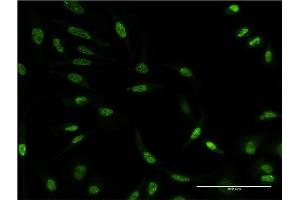 Immunofluorescence of monoclonal antibody to AKT3 on HeLa cell. (AKT3 antibody  (AA 100-189))