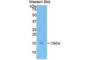 Detection of Recombinant BNP, Mouse using Polyclonal Antibody to Brain Natriuretic Peptide (BNP) (BNP antibody  (AA 77-121))