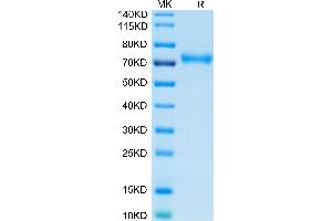 Human CD229 on Tris-Bis PAGE under reduced condition. (LY9 Protein (AA 48-454) (His-Avi Tag))