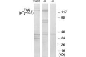 Western blot analysis of extracts from Jurkat and HepG2 cells, using FAK (Phospho-Tyr925) Antibody. (FAK antibody  (pTyr925))