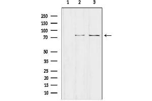 Western blot analysis of lysates from various samples, using NCKIPSD Antibody.