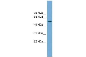 WB Suggested Anti-EFCAB3 Antibody Titration: 0. (EFCAB3 antibody  (N-Term))