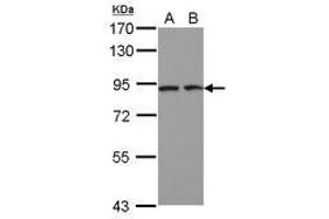 Image no. 2 for anti-Discoidin, CUB and LCCL Domain Containing 2 (DCBLD2) (AA 489-750) antibody (ABIN1497772)