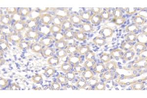 Detection of SPTAN1 in Mouse Kidney Tissue using Polyclonal Antibody to Alpha-Fodrin (SPTAN1) (SPTAN1 antibody  (AA 1049-1207))