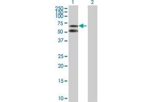 Western Blot analysis of ALB expression in transfected 293T cell line by ALB MaxPab polyclonal antibody.