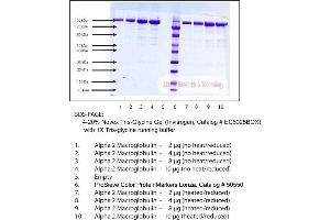 Gel Scan of Alpha 2 Macroglobulin, Human Plasma, Fast Form  This information is representative of the product ART prepares, but is not lot specific. (alpha 2 Macroglobulin Protein)