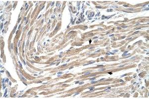 Immunohistochemical staining (Formalin-fixed paraffin-embedded sections) of human muscle with MGST2 polyclonal antibody . (MGST2 antibody  (AA 1-50))