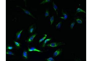 Immunofluorescent analysis of Hela cells using ABIN7145013 at dilution of 1:100 and Alexa Fluor 488-congugated AffiniPure Goat Anti-Rabbit IgG(H+L) (KCNJ1 antibody  (AA 178-391))