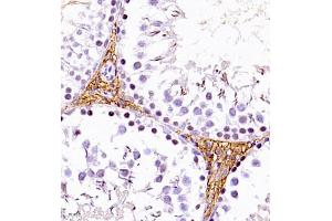 Immunohistochemistry of paraffin embedded rat testis using SLC7A8 (ABIN7074503) at dilution of 1:1100 (400x lens) (LAT2 antibody)