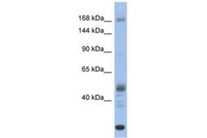 Image no. 1 for anti-Chromodomain Helicase DNA Binding Protein 1 (CHD1) (AA 1331-1380) antibody (ABIN6742464) (CHD1 antibody  (AA 1331-1380))